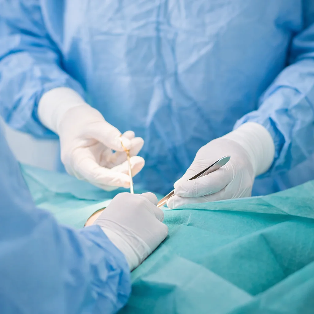 Ambulante Operationen